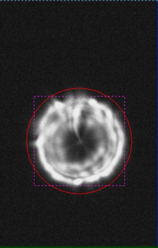 image collimation