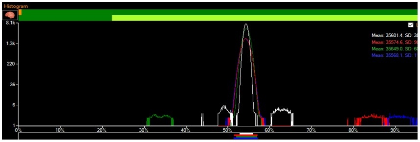 with Dark subtract added in Preprocessing